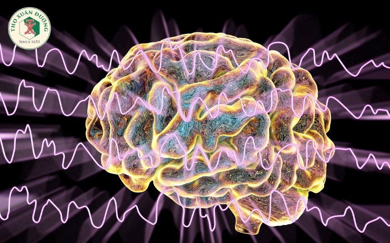 Tìm hiểu sơ lược về điện não đồ